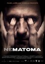 Nematoma