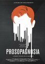 Prosopagnosia